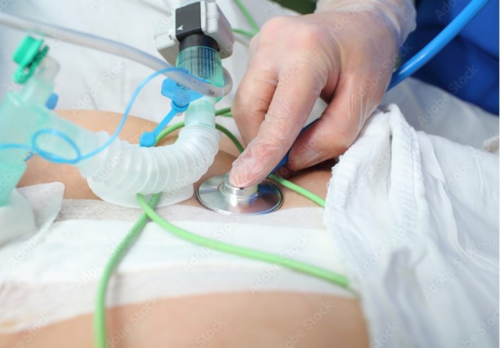 What is Pulmonary Nurse Practitioner?
