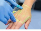 How To Become A Vascular Access Nurse?